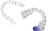 Picture of Aligners (BlueSkyBio.com)